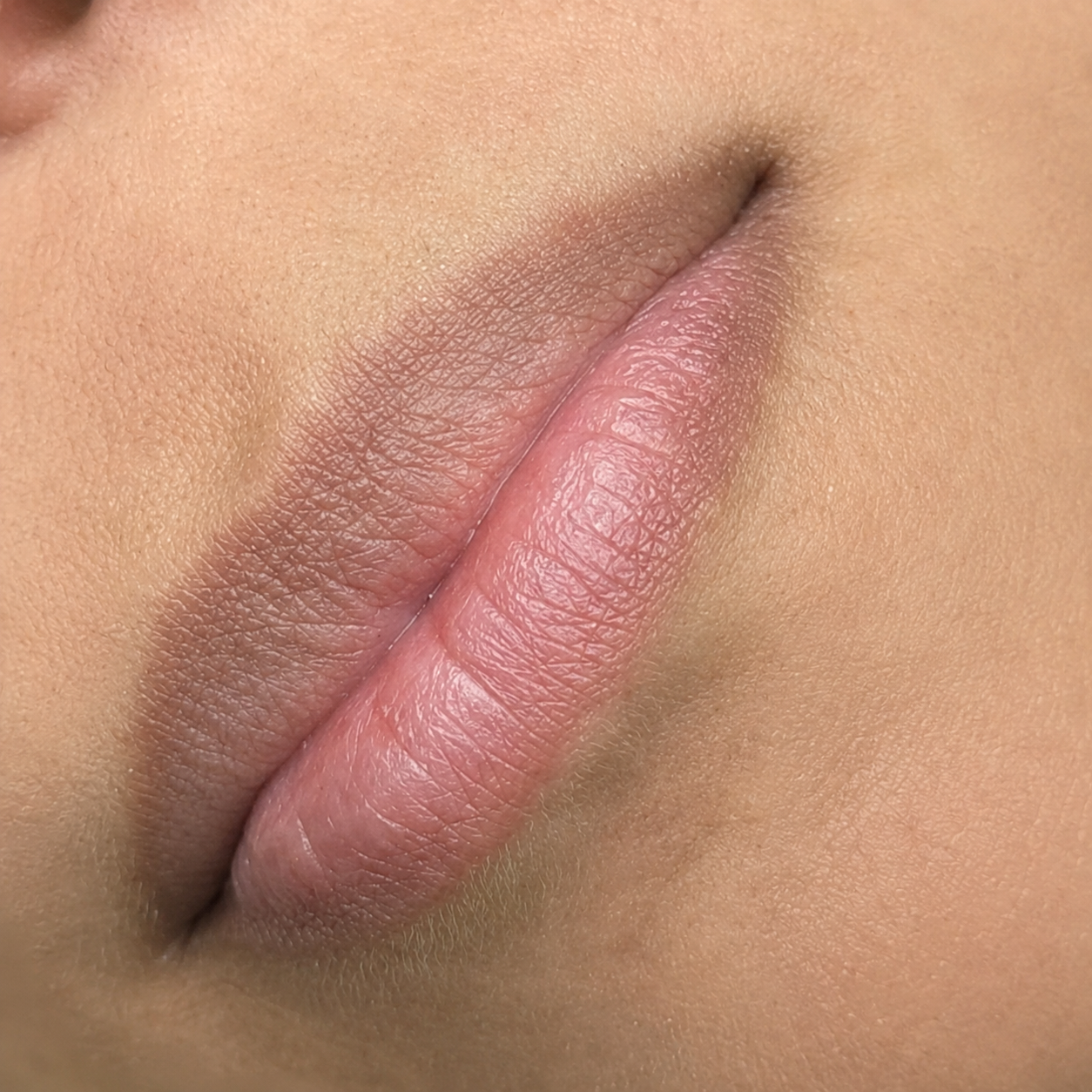 Paciente antes de la neutralización y micropigmentación labial